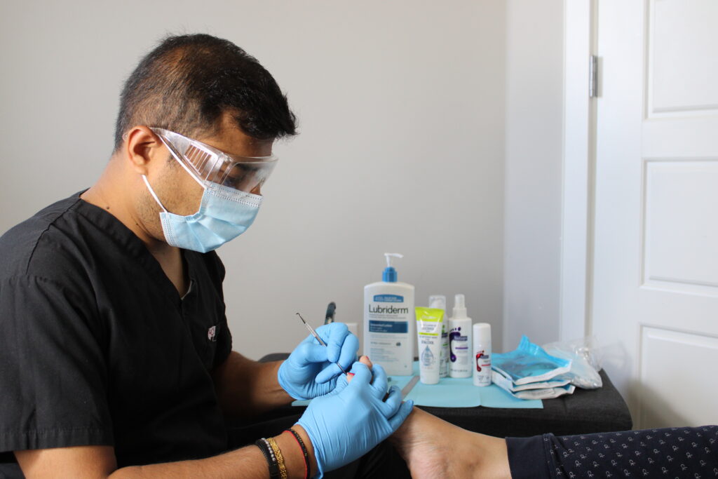 IMG 5224 What Causes Ingrown Toenails and How to Prevent Them Fabulousfootcare nurse