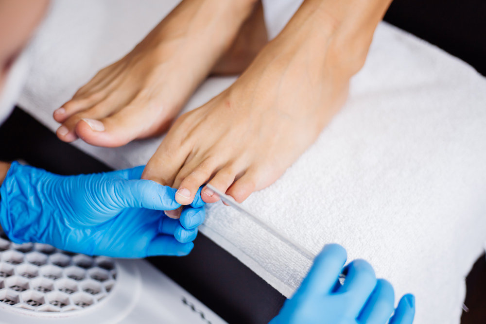 ingrown toenail treatment